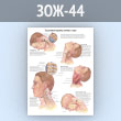 Плакат «Хлыстовые травмы головы и шеи» (ЗОЖ-44, пластик 2 мм, А1, 1 лист)